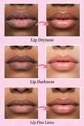 Lip Moisturizing Mask